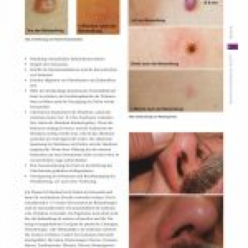 Ästhetische Dermatologie - Jett-Plasma-Lift-Medical-in-german-media-page-002-150x150.jpg